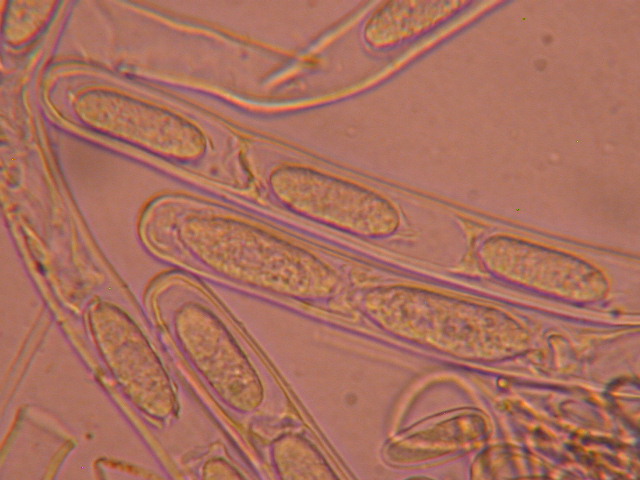 Sarcoscypha jurana... al microscopio